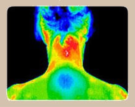 Thermography